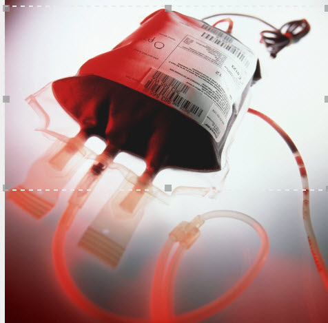 Transfusion Reaction and Interventions