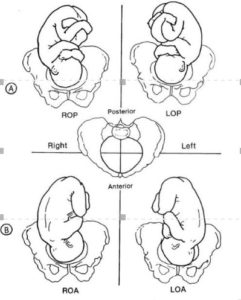 Fetal Positions