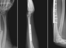 Peds Musculoskeletal