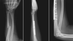Peds Musculoskeletal