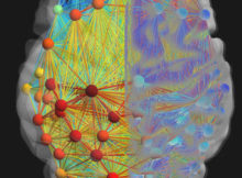 neurological NCLEX topics