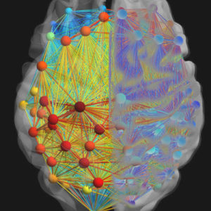 neurological NCLEX topics