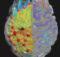 neurological NCLEX topics